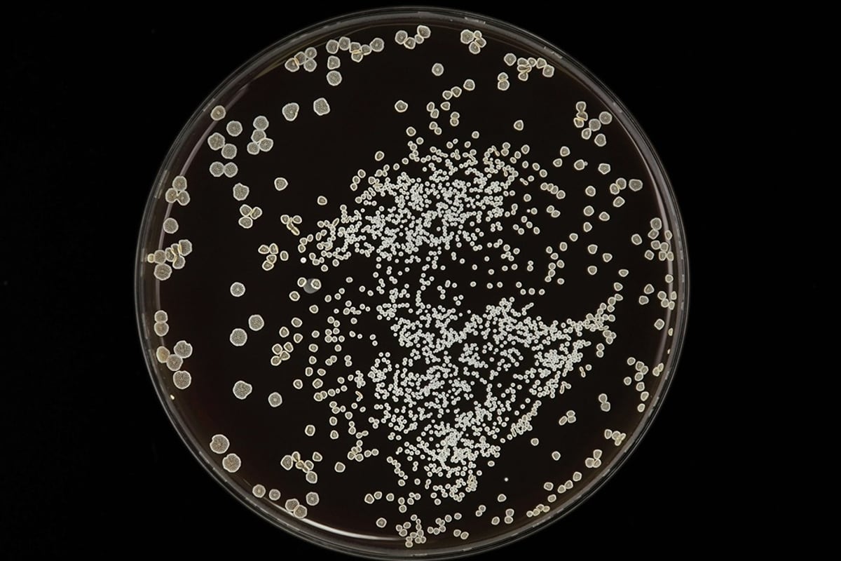several bacterias in a petri plate